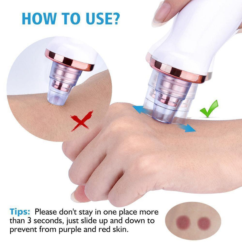 Blackhead Remover Vacuum, Visit iBuyXi.com for Online Shopping and Shop the Unique Selection, Blackhead Remover, Blackhead Vacuum, Skincare, Skincare Machine, Pimple Remover, Pimple, Clear Skin, Clean Skin, Pore Cleaner.