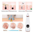 Blackhead Remover Vacuum, Visit iBuyXi.com for Online Shopping and Shop the Unique Selection, Blackhead Remover, Blackhead Vacuum, Skincare, Skincare Machine, Pimple Remover, Pimple, Clear Skin, Clean Skin, Pore Cleaner.