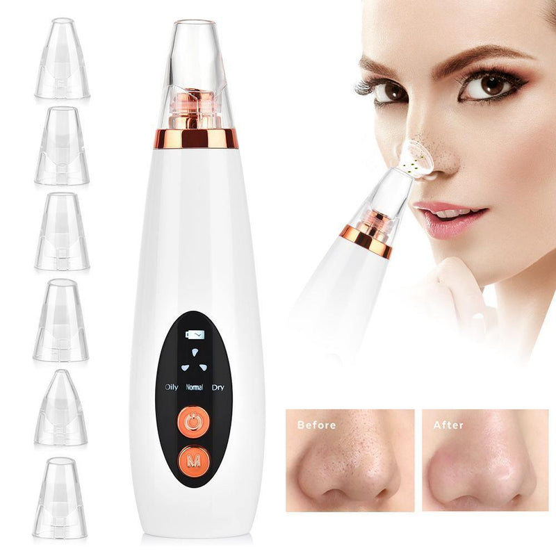 Blackhead Remover Vacuum, Visit iBuyXi.com for Online Shopping and Shop the Unique Selection, Blackhead Remover, Blackhead Vacuum, Skincare, Skincare Machine, Pimple Remover, Pimple, Clear Skin, Clean Skin.